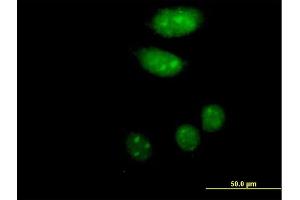 Immunofluorescence of purified MaxPab antibody to ISL2 on HeLa cell. (ISL2 抗体  (AA 1-359))