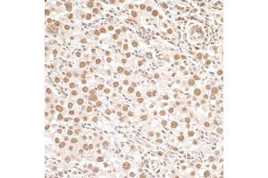 Immunohistochemistry (IHC) image for anti-Structural Maintenance of Chromosomes 1A (SMC1A) (pSer966) antibody (ABIN7455211) (SMC1A 抗体  (pSer966))