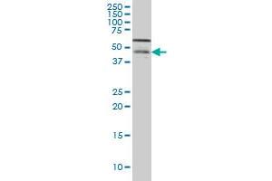 CSNK1G1 monoclonal antibody (M04), clone 8A4 Western Blot analysis of CSNK1G1 expression in Hela S3 NE . (CSNK1G1 抗体  (AA 293-393))