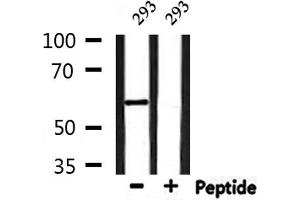 Western blot analysis of extracts from 293, using YTHDF1 Antibody. (YTHDF1 抗体  (N-Term))