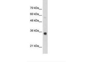 Image no. 1 for anti-Homeobox B4 (HOXB4) (N-Term) antibody (ABIN203345) (HOXB4 抗体  (N-Term))