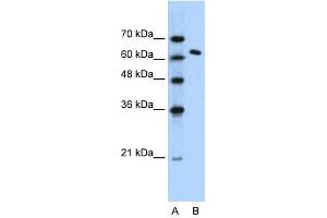 SUPT16H antibody (20R-1066) used at 0. (SUPT16H 抗体  (N-Term))