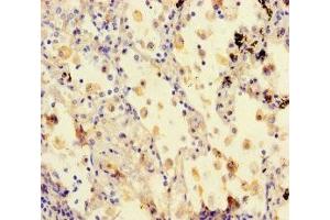 Immunohistochemistry (IHC) image for anti-Syntaxin Binding Protein 6 (Amisyn) (STXBP6) (AA 2-210) antibody (ABIN7171269)