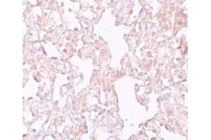 Immunohistochemistry (IHC) image for anti-Major Facilitator Superfamily Domain Containing 1 (MFSD1) (Middle Region) antibody (ABIN1031003) (MFSD1 抗体  (Middle Region))