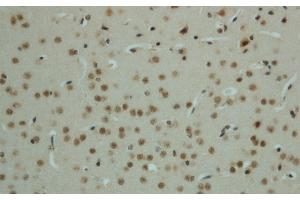 Immunohistochemistry of paraffin-embedded mouse brain using Phospho-AMPK alpha1/2 (Thr183/172) Polyclonal Antibody at dilution of 1:50 (PRKAA1/PRKAA2 抗体  (pThr172, pThr183))