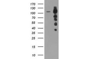 HEK293T cells were transfected with the pCMV6-ENTRY control (Left lane) or pCMV6-ENTRY TACC3 (Right lane) cDNA for 48 hrs and lysed. (TACC3 抗体)