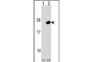 Western blot analysis of UBE2G1 (arrow) using rabbit polyclonal UBE2G1 Antibody (C-term) (ABIN1536693 and ABIN2848805). (UBE2G1 抗体  (C-Term))