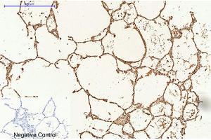 Immunohistochemical analysis of paraffin-embedded human lung tissue. (Caspase 9 抗体)