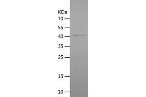 Orosomucoid 2 Protein (ORM2) (AA 19-201) (His-IF2DI Tag)