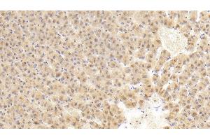 Detection of FIGN in Human Liver Tissue using Polyclonal Antibody to Fidgetin (FIGN) (Fidgetin 抗体  (AA 1-308))