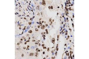 Immunohistochemistry (IHC) image for anti-Histone H3 (H3) (H3K27me) antibody (ABIN3023266) (Histone 3 抗体  (H3K27me))
