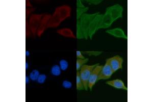 ABIN6257883 and ABIN6275262 staining Hela cells by IF/ICC. (MYOM2 抗体  (Internal Region))