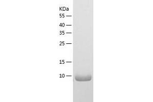 Western Blotting (WB) image for S100 Calcium Binding Protein A1 (S100A1) (AA 1-94) protein (His tag) (ABIN7124944) (S100A1 Protein (AA 1-94) (His tag))