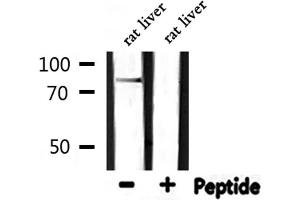 Western blot analysis of extracts from rat liver, using CDH18 Antibody. (CDH18 抗体  (N-Term))