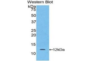 Western blot analysis of the recombinant protein. (LAMB2 抗体  (AA 1176-1309))