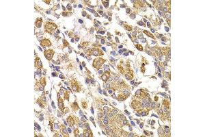 Immunohistochemistry of paraffin-embedded human stomach using METTL7B antibody at dilution of 1:100 (40x lens). (METTL7B 抗体)