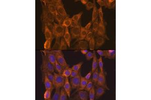 Immunofluorescence (IF) image for anti-Retinoic Acid Receptor, alpha (RARA) (AA 1-457) antibody (ABIN6146692)