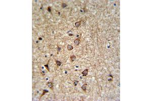 Immunohistochemistry (IHC) image for anti-Solute Carrier Family 25, Member 37 (SLC25A37) antibody (ABIN3004289) (SLC25A37 抗体)
