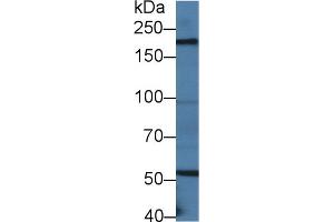 Western Blot; Sample: Mouse Small intestine lysate; ;Primary Ab: 2µg/ml Rabbit Anti-Mouse LAMb2 Antibody;Second Ab: 0. (LAMB2 抗体  (AA 1498-1716))