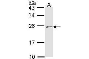 WB Image Sample (30 ug of whole cell lysate) A: Raji 12% SDS PAGE antibody diluted at 1:1000 (Endothelin 3 抗体)