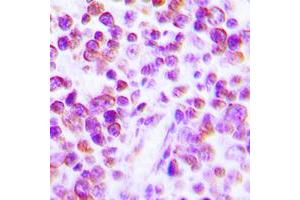 Immunohistochemistry (IHC) image for anti-Tumor Necrosis Factor alpha (TNF alpha) (Center) antibody (ABIN7297164)