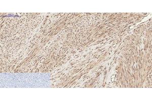 Immunohistochemistry of paraffin-embedded Human uterus tissue using Phospho-CHEK2 (Thr68) Polyclonal Antibody at dilution of 1:200 (CHEK2 抗体  (pThr68))
