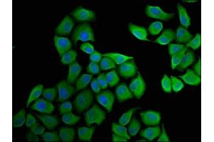 Immunofluorescence staining of Hela cells with ABIN7152029 at 1:33, counter-stained with DAPI. (HSD17B1 抗体  (AA 268-328))