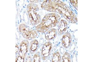 Immunohistochemistry of paraffin-embedded mouse kidney using PEG10 Rabbit pAb (ABIN3016692, ABIN3016693, ABIN1681320 and ABIN6219814) at dilution of 1:100 (40x lens). (PEG10 抗体  (AA 1-325))