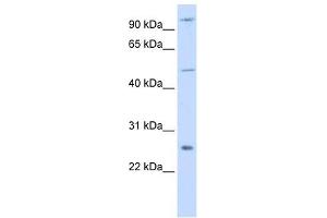 TRAF4 antibody (70R-10513) used at 0. (TRAF4 抗体  (Middle Region))