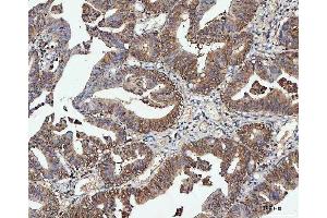 IHC analysis of PPP2CA using anti-PPP2CA antibody (ABIN3043356).