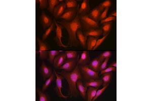 Immunofluorescence analysis of U2OS cells using Ataxin-3  Rabbit pAb (ABIN3021828, ABIN3021829, ABIN3021830, ABIN1512615 and ABIN6216049) at dilution of 1:100 (40x lens). (Ataxin 3 抗体  (AA 1-364))