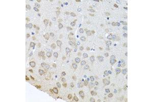 Immunohistochemistry of paraffin-embedded mouse brain using PABPC4 antibody at dilution of 1:100 (40x lens). (PABPC4 抗体)
