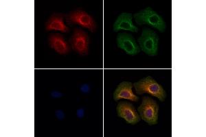 ABIN7094580 and ABIN7098629 staining Hela cells by IF/ICC.