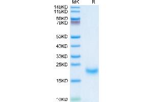 Human/Cynomolgus/Rhesus macaque ROR1 (308-395, Kringle Domain) on Tris-Bis PAGE under reduced condition.