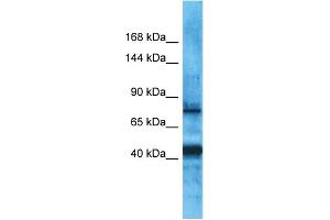 Host:  Rabbit  Target Name:  PDZRN3  Sample Type:  Uterus Tumor lysates  Antibody Dilution:  1. (PDZRN3 抗体  (Middle Region))