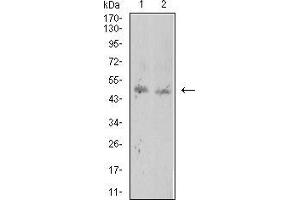 Western blot analysis using ROP1 mouse mAb against BCBL-1 (1) and Raw264. (ROP1 (AA 42-183) 抗体)