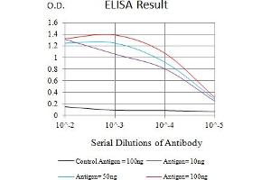 Black line: Control Antigen (100 ng),Purple line: Antigen (10 ng), Blue line: Antigen (50 ng), Red line:Antigen (100 ng) (TEK 抗体  (AA 571-748))