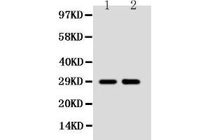 Anti-SSX2 antibody, Western blotting Lane 1: MCF-7 Cell Lysate Lane 2: HELA Cell Lysate (SSX2 抗体  (C-Term))