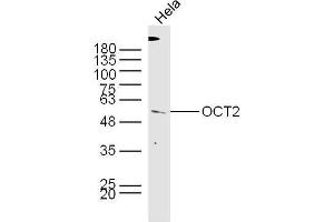 HeLa lysates probed with Rabbit Anti-OCT2 Polyclonal Antibody, Unconjugated  at 1:300 overnight at 4˚C. (Oct-2 抗体  (AA 11-100))