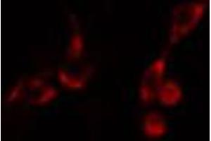 ABIN6266697 staining HeLa cells by IF/ICC. (PDZD2 抗体  (N-Term))