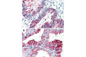 Immunohistochemical staining of human uterus (A) and human prostate (B) with GPR27 polyclonal antibody . (GPR27 抗体  (Cytoplasmic Domain))