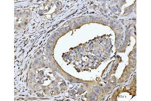 IHC analysis of EDEM3 using anti-EDEM3 antibody (ABIN7602003). (EDEM3 抗体  (AA 54-795))