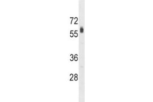 SPHK2 antibody western blot analysis in HepG2 lysate. (SPHK2 抗体  (AA 590-620))
