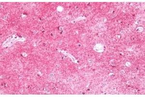Immunohistochemistry (IHC) image for anti-Potassium Large Conductance Calcium-Activated Channel, Subfamily M, beta Member 4 (KCNMB4) (AA 86-140) antibody (ABIN2879462)