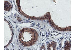 Immunohistochemical staining of paraffin-embedded Human breast tissue using anti-FDFT1 mouse monoclonal antibody. (FDFT1 抗体)