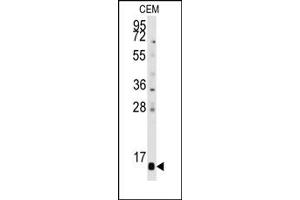 Image no. 1 for anti-Prefoldin Subunit 6 (PFDN6) (C-Term), (N-Term) antibody (ABIN358008) (PFDN6 抗体  (C-Term, N-Term))