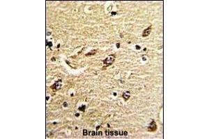 Formalin-fixed and paraffin-embedded human brain tissue reacted with ND5 Antibody (C-term), which was peroxidase-conjugated to the secondary antibody, followed by DAB staining. (MT-ND5 抗体  (C-Term))