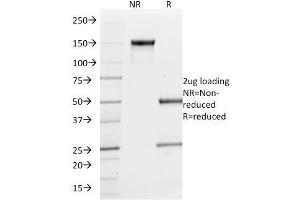 SDS-PAGE (SDS) image for anti-Spleen Focus Forming Virus (SFFV) Proviral Integration Oncogene Spi1 (SPI1) (AA 16-170) antibody (ABIN6940631)