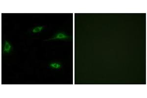 Immunofluorescence analysis of LOVO cells, using OR2T11 antibody. (OR2T11 抗体  (Internal Region))