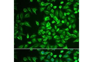 Immunofluorescence analysis of U2OS cells using LRat Polyclonal Antibody (LRAT 抗体)